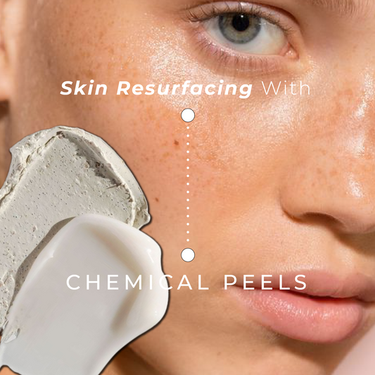Chemical Peels - Your Whole Face Will Peel Off....