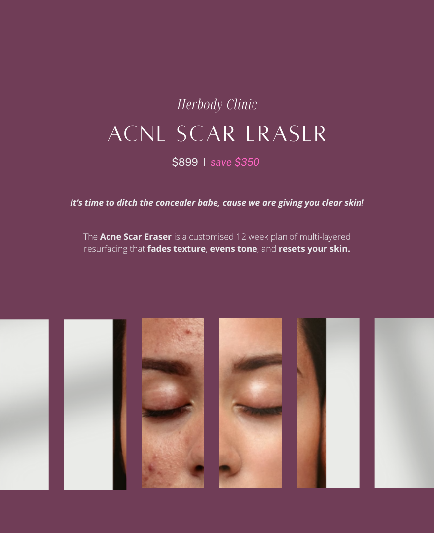 ACNE SCAR ERASER: Complete Skinmark Series